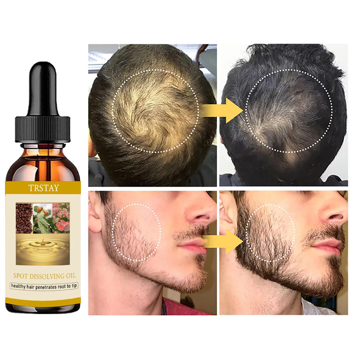 50ML Beard Growth Oil Anti Alo - Beard Oil review and price